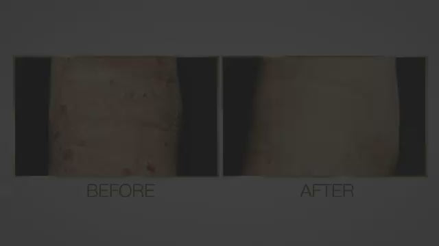 Load video: Testimonial Video